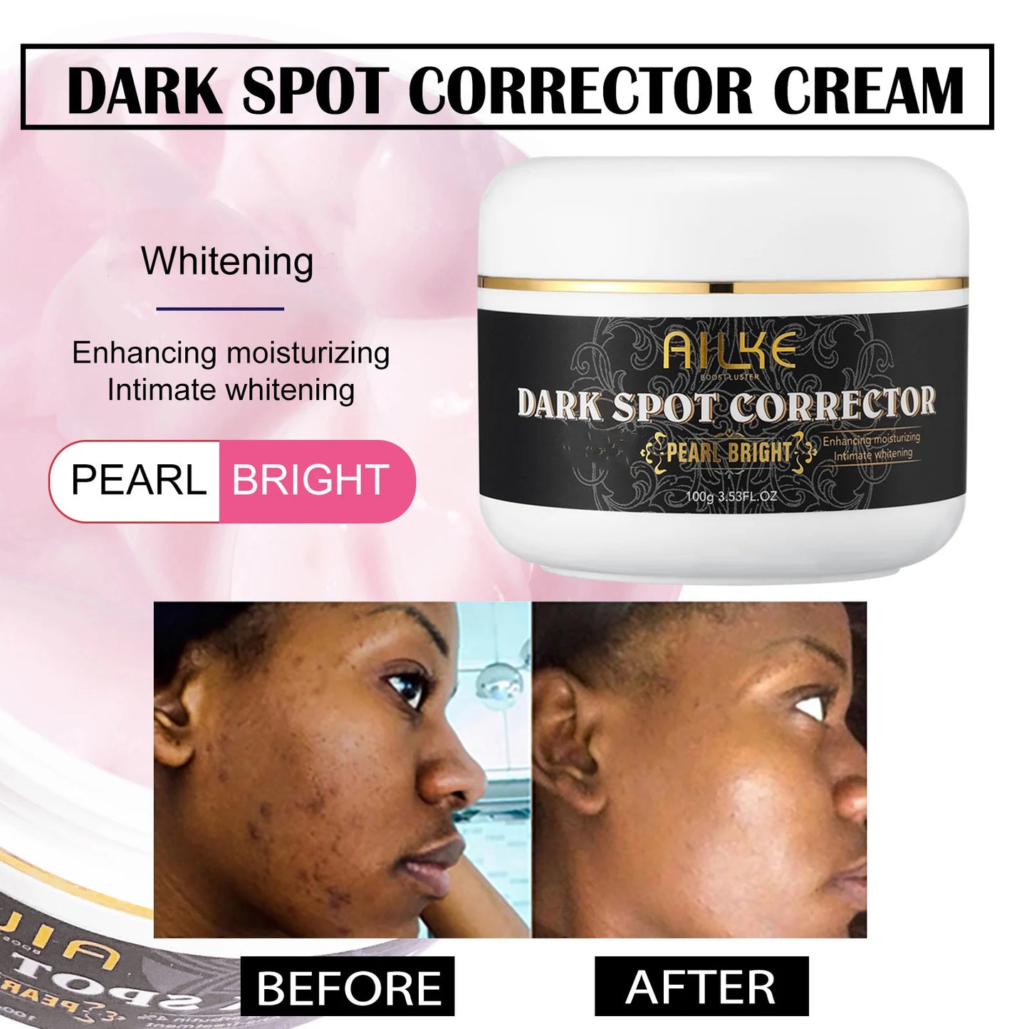 AILKE Collagen Women Skin Care Set, Moisturizing, Whitening, Remove Freckles, Dark Spots, Black Spots, Skin Lightening Kit