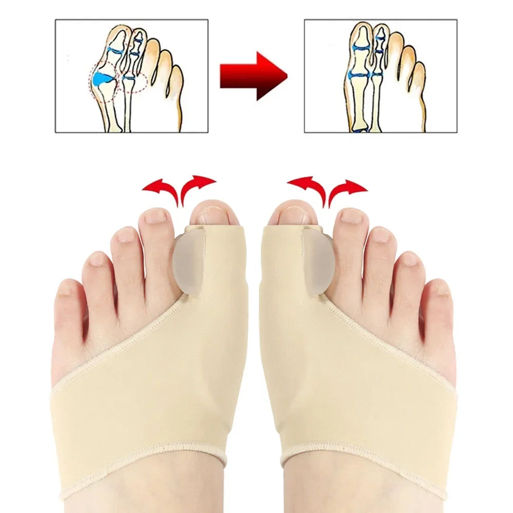1p1Pair Toe Separator Bunion Corrector Toe Brace Orthopedic Hallux Valgus Relief Bone Thumb Adjuster Correction for Men and 2026