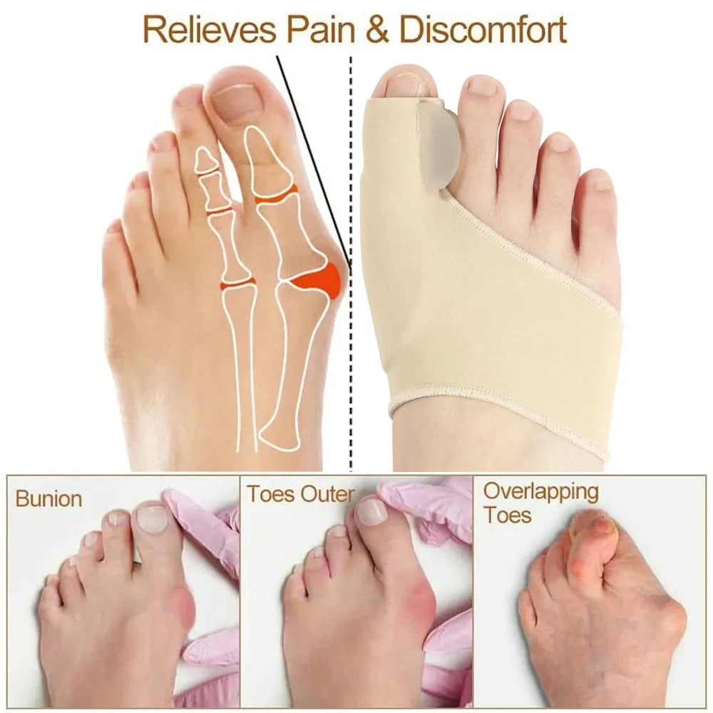 1p1Pair Toe Separator Bunion Corrector Toe Brace Orthopedic Hallux Valgus Relief Bone Thumb Adjuster Correction for Men and 2026